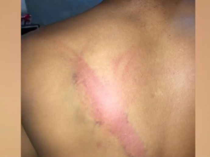 Pol&iacute;cia Investiga agress&atilde;o a gar&ccedil;om em festa em Marechal Deodoro