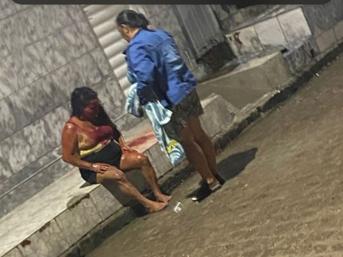 Mulher &eacute; esfaqueada no rosto por companheiro em P&atilde;o de A&ccedil;&uacute;car