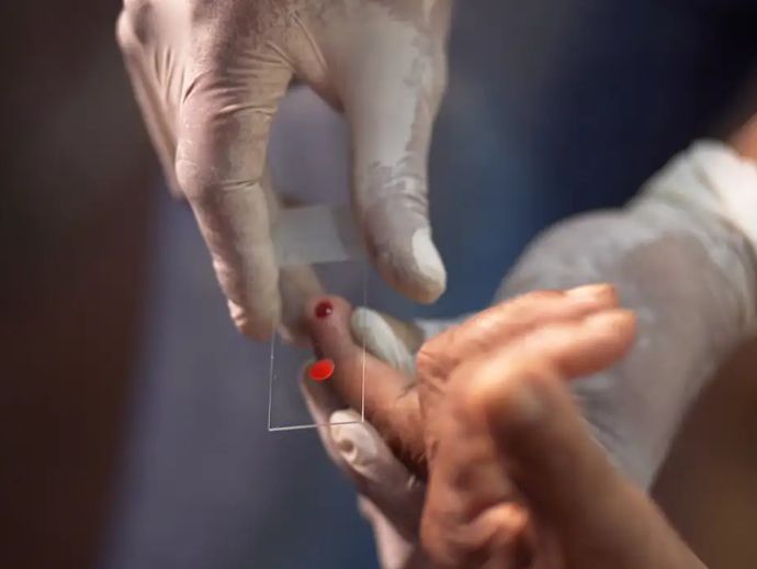 SUS come&ccedil;a a usar novo tratamento contra a mal&aacute;ria em crian&ccedil;as