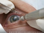 Cirurgia que altera cor do olho tem uso restrito para pessoas cegas